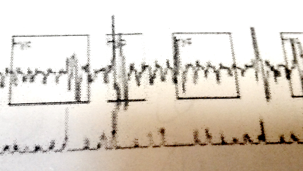 Section of data collected during a sleep study